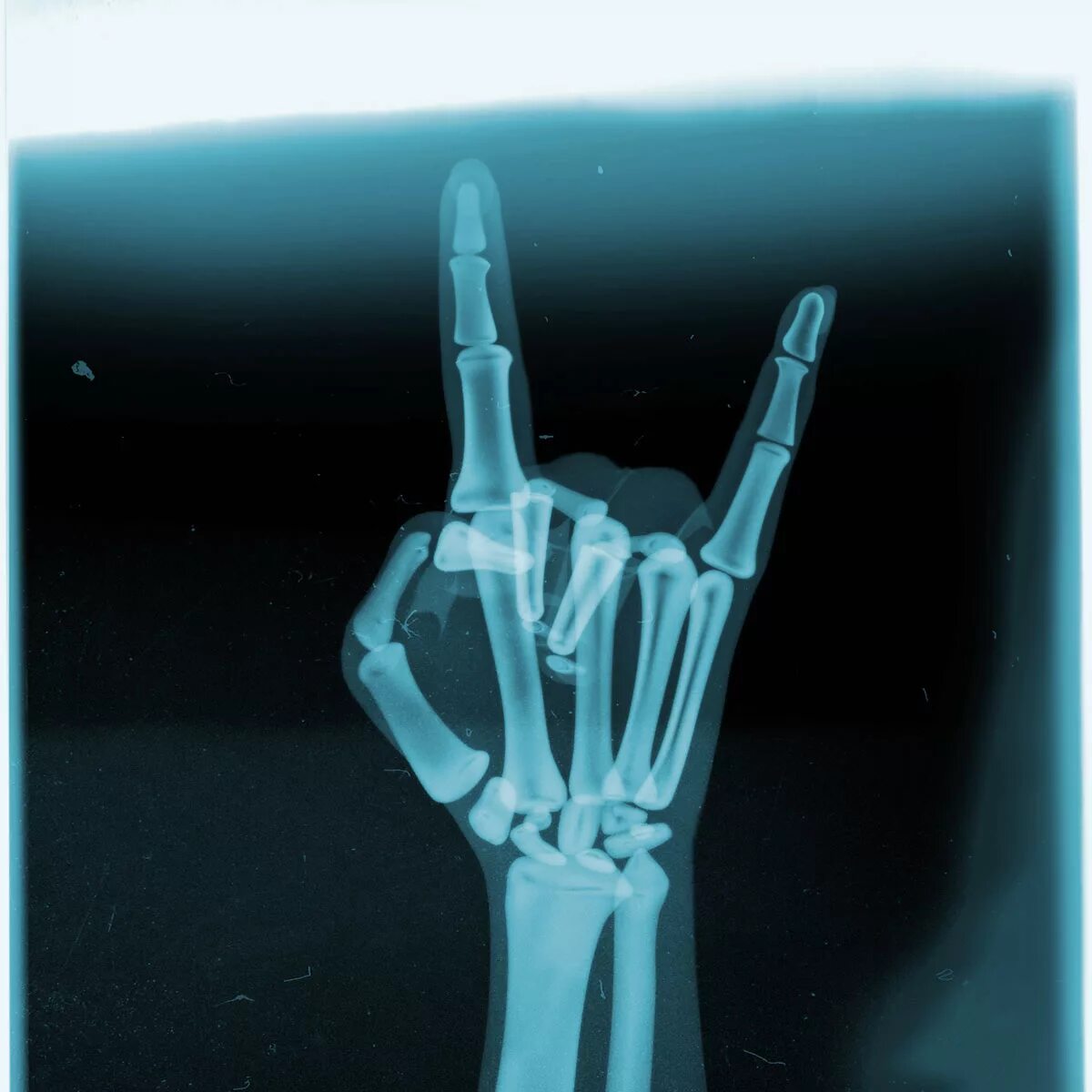 Source x rays