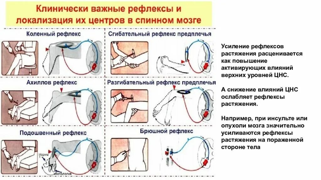 Усиление рефлексов. Рефлекс растяжения мышцы. Рефлекторная дуга рефлекса растяжения. Схема рефлекса растяжения.