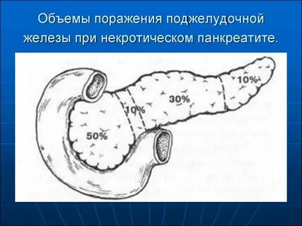 Реактивные изменения поджелудочной железы