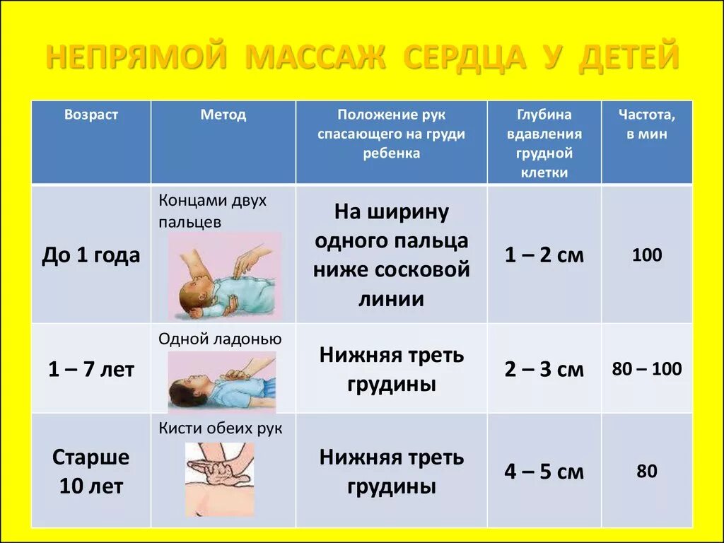 Частота искусственного дыхания в минуту. Частота компрессий при непрямом массаже сердца у детей:. Непрямой массаж сердца у детей. Непрямой массаж сердца ребенку до 1 года.