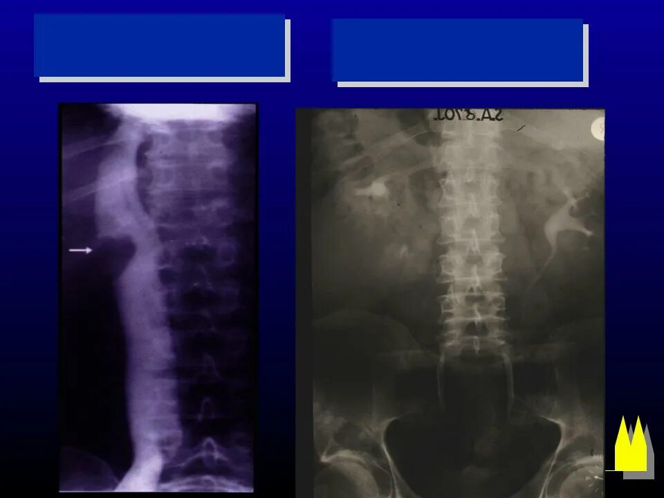 Мр урография. Мр урография. Магнитно-резонансная урография. Мр урография. Мр урография.