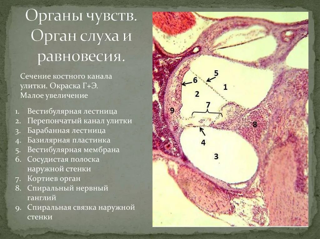 Строение внутреннего уха гистология. Улитковый Лабиринт гистология препарат. Орган слуха строение гистология. Кортиев орган гистологический препарат. Чувствительные клетки внутреннего уха