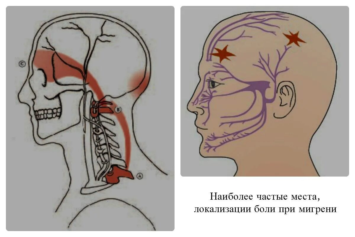 Стреляющая боль в голове с левой стороны за ухом. Головное стреляние в затылок. Болит голова в левой части затылка. Нейропатия затылочного нерва