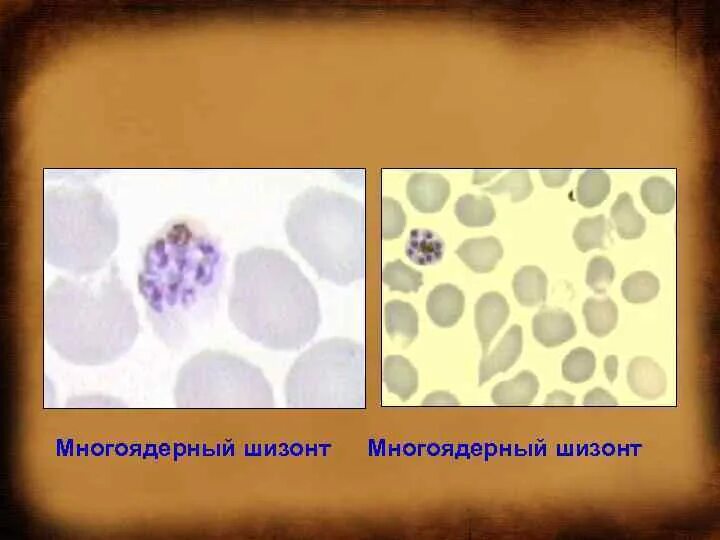 Многоядерный шизонт. Многоядерный плазмодий шизонт. Одноядерный шизонт. Однряереый и многоядереый шизонд у коецидии. Шизонт это