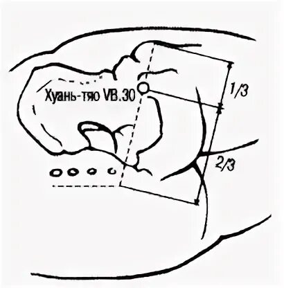 Точка vb30. Хуань тяо точка. Точка vb30 Хуань-тяо. Vb 30 точка акупунктуры. Ла тяо
