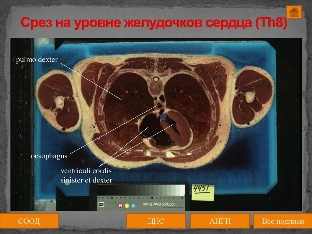 Срез человеческого тела. Срез сердца.