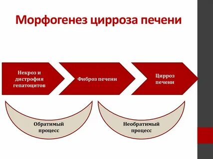 Виды цирроза