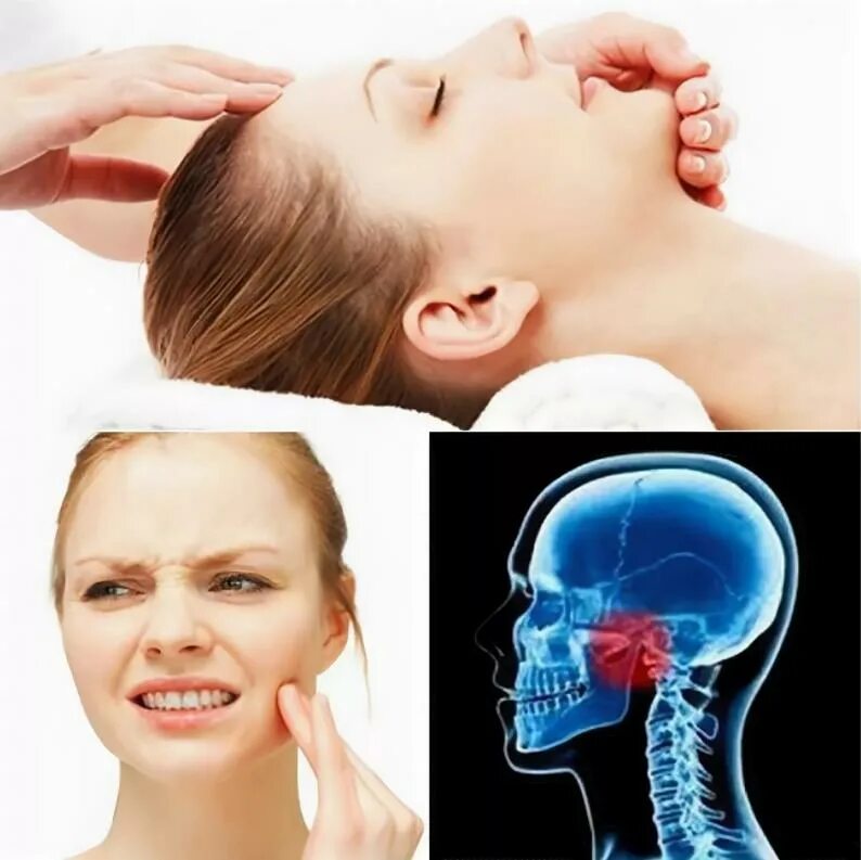 Височно челюстной сустав артроз симптомы. Как лечить височный сустав. Деформирующий артрит внчс. Артроз суставов челюсти симптомы. Височно челюстной сустав суставные поверхности.