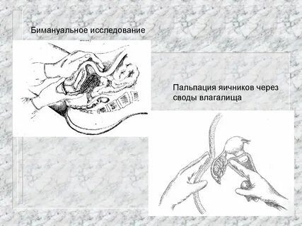 Пальпация матки
