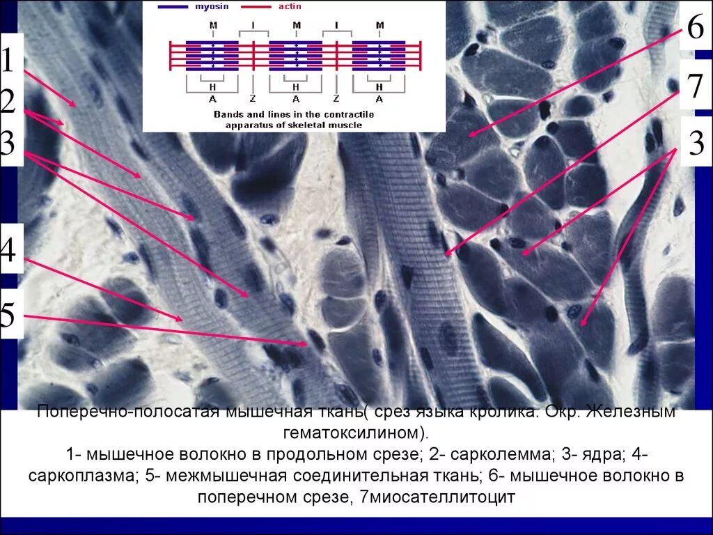 Поперечно-полосатая Скелетная мышечная ткань препарат. Препарат Скелетная мышечная ткань языка. Поперечно полосатая мышечная ткань языка гистология препарат. Поперечно полосатая Скелетная мышечная ткань гистология препарат. Препарат поперечно полосатая мышечная ткань