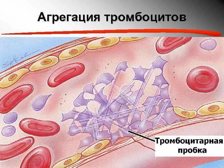 Тромбоцитах делают операцию. Агрегация (слипание) тромбоцитов. Тромбоцитнери агрегация. Слипание тромбоцитов. Склеивание тромбоцитов.