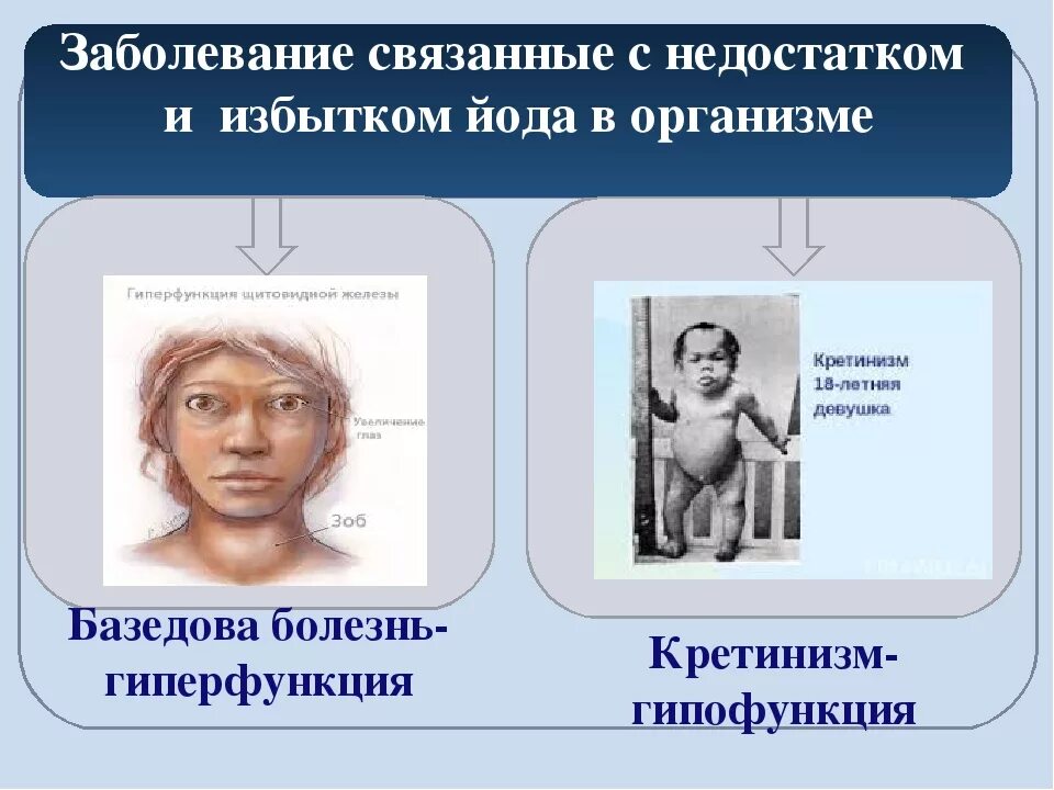 Недостаток йода может привести к развитию ответ. Болезни связанные с дефицитом йода. Избвток и недостаокйода. Недостаток йода в организме болезнь. Заболевания при недостатке йода.