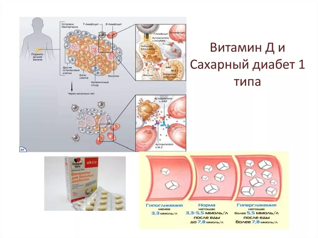 При сахарном диабете принимать витамины. Витамин д и диабет. Витамин д при сахарном диабете 1 типа у детей. Витамин д и сахарный диабет презентация. Витамин д при сахарном диабете 1 Тип.