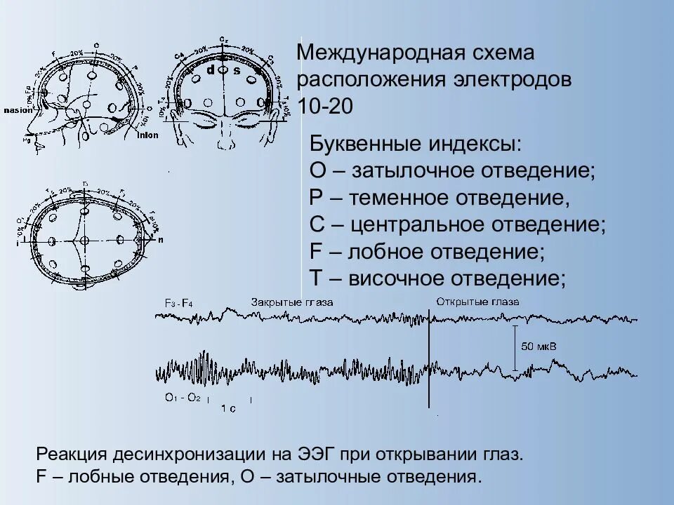 Анализы цнс. ЭЭГ схема наложения. Схема наложения электродов ЭЭГ. ЭЭГ головного мозга наложение электродов. ЭЭГ схема крепления электродов.