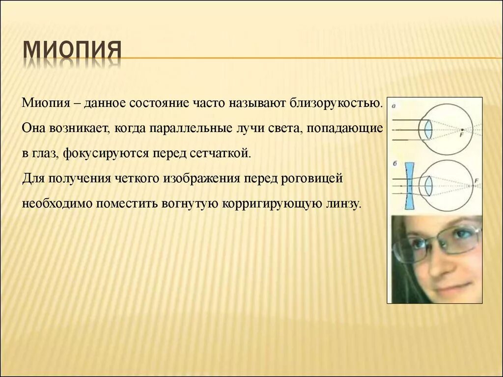 Миопия что это такое у детей. Миопия. Близорукость миопия. Близорукость слабой степени. Миопия слабой степени.