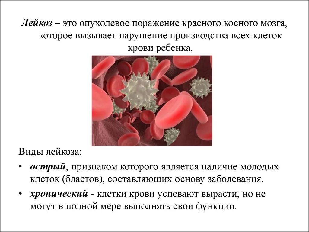 Злокачественные заболевания крови. Лейкоз симптомы у детей симптомы. Лейкемия симптомы у детей симптомы.