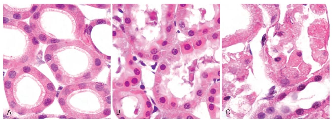Reversed cell