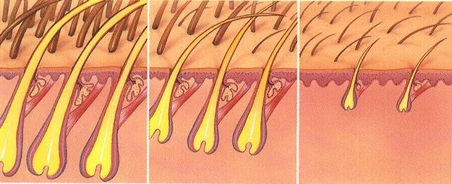 Растут корни волос. Волосяная луковица. Фолликулы волос на голове. Волосяной фолликул и луковица.