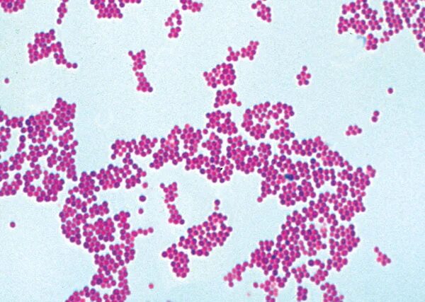 Кишечная палочка энтерококк. S. aureus золотистый стафилококк. Staphylococcus aureus эпидермиальный. Энтерококки кишечная палочка. Немноготповышены энтерококки.