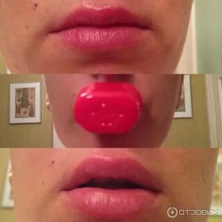 Со скольки лет можно делать губы