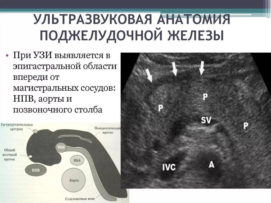 Поджелудочная железа узи норма у мужчин. Ультразвуковая анатомия сосудов брюшной полости. УЗИ поджелудочной железы норма. Крючковидный отросток поджелудочной железы. УЗИ анатомия поджелудочной железы.