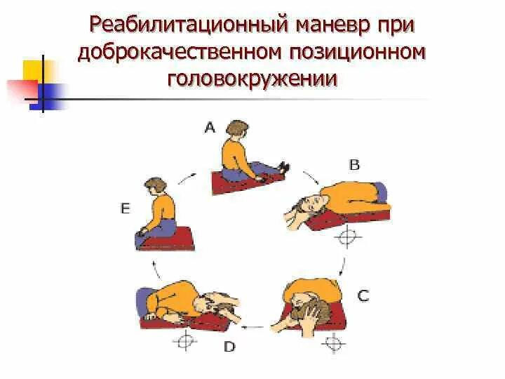 Упражнения брандта дароффа при головокружении. Позиционные маневры эпли. маневры эпли при головокружении. вестибулярная гимнастика эпли. вестибулярная гимнастика маневр эпли.