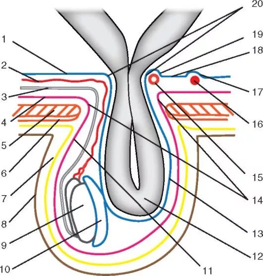 прямая и косая паховые грыжи. косая паховая грыжа операция. косая вправимая паховая грыжа. схема косых и прямых паховых грыж. через какую ямку проходит косая паховая грыжа.