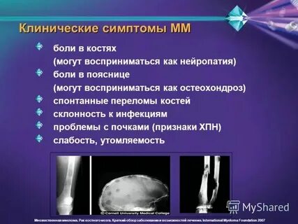 Рак костей симптомы