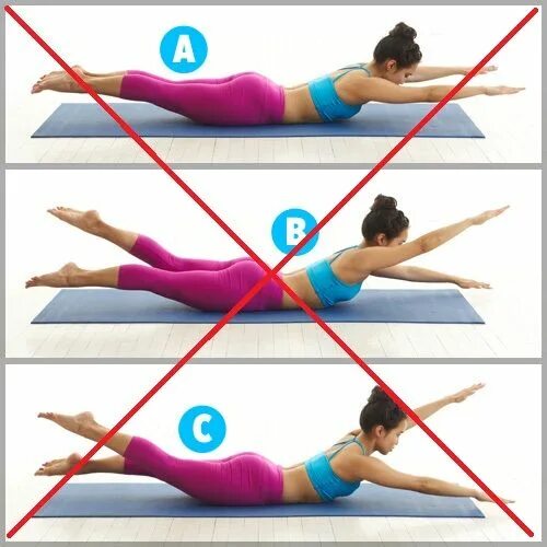 Williams exercises. Exercises spondylolisthesis. спондилолистез можно ли заниматься йогой. exercises for spondylolisthesis.