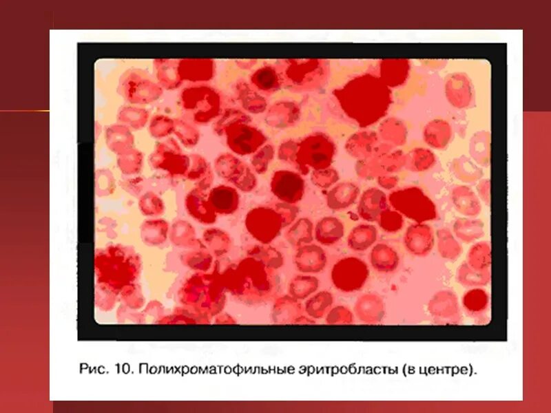 В12 в эритроцитах. В12 в эритроцитах