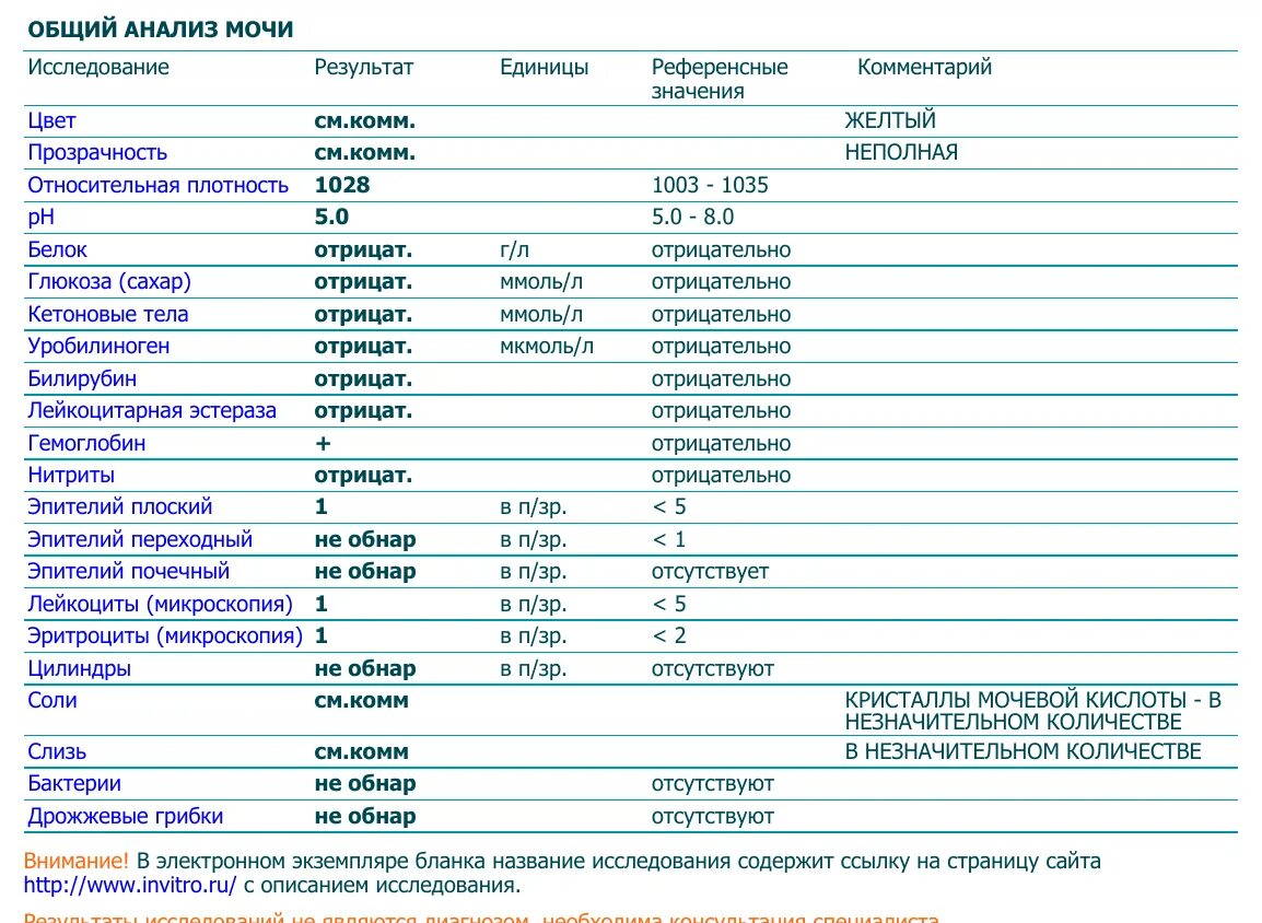 Повышенный эпителий в моче у мужчин. Общий анализ мочи норма пример. Показатели общего анализа мочи у детей расшифровка. Общий клинический анализ мочи норма. Общий анализ мочи Результаты норма.