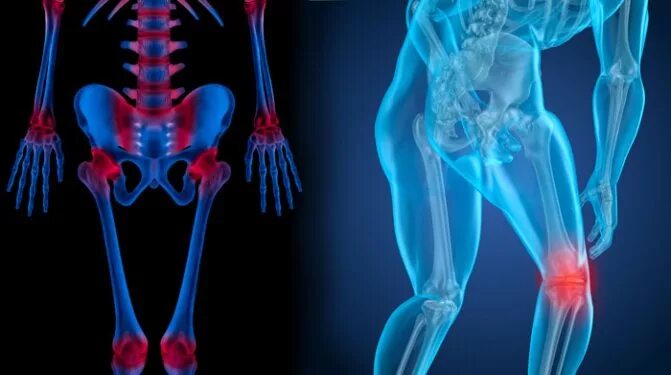 Костно мышечной системы и соединительной. Костно мышечной системы и соединительной