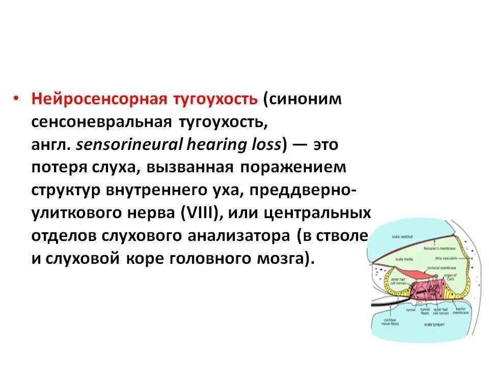 Симптомы тугоухости у взрослых. Нейросенсорная тугоухость и глухота связана с патологией. Острая нейросенсорная тугоухость симптомы. Симптомы сенсоневральной тугоухости. Несиндромальной нейросенсорной тугоухости.