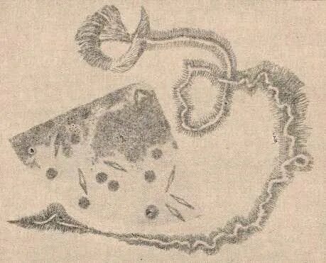 Кристаллы шарко лейдена. Спирали куршмана и кристаллы шарко-лейдена. спирали куршмана микроскопия. микроскопия мокроты спирали куршмана. куршмана и шарко лейдена.