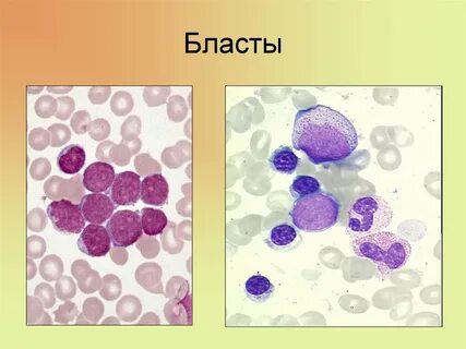 Бластные клетки