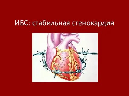 Хирургическое лечение ишемической болезни