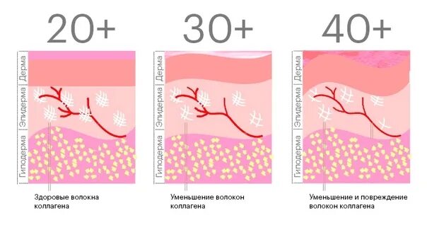 Когда есть коллаген. Кожа с дефицитом коллагена. выработка коллагена в коже. коллагеновые волокна кожи. отсутствие коллагена в коже.