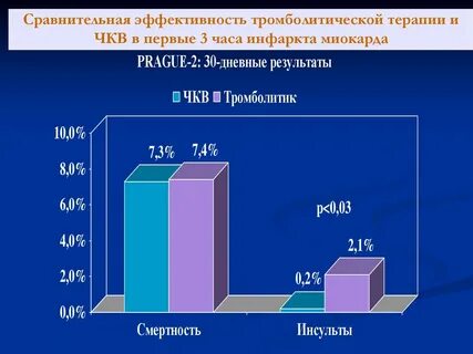Тромболитическая терапия при остром инфаркте миокарда