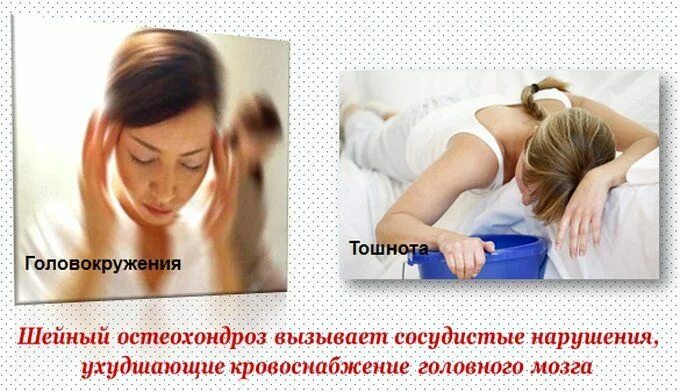 Как лечить шейное головокружение. Шейный остеохондроз кружится голова. шейный остеохондроз и головокружение. головокружение и тошнота. головокружение при остеохондрозе.