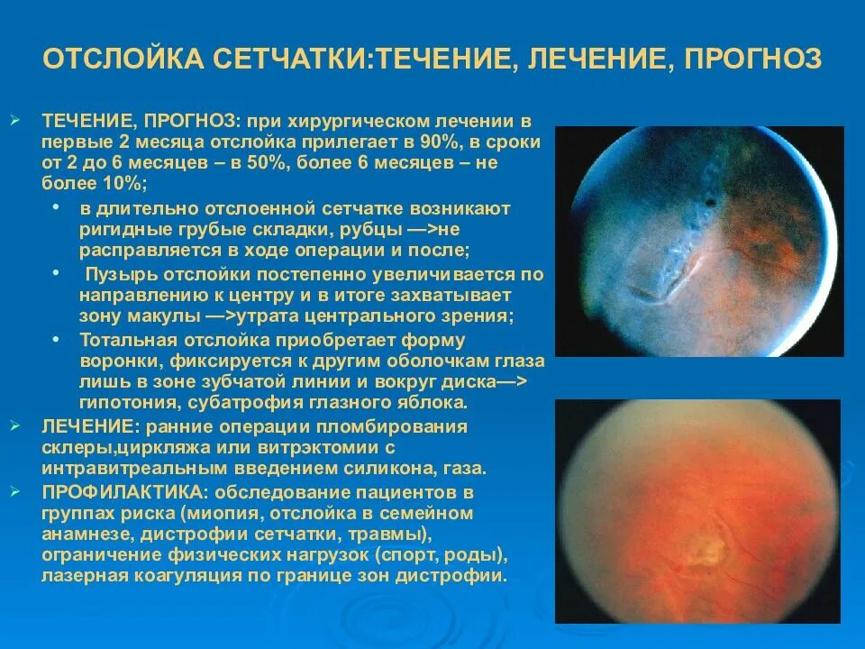 После операции сетчатки глаза ограничения. Причины первичной отслойки сетчатки. Отслоение сетчатки глаза симптомы. Отслоение сетчатки глазное дно. Признаки отслоения сетчатки глаза.