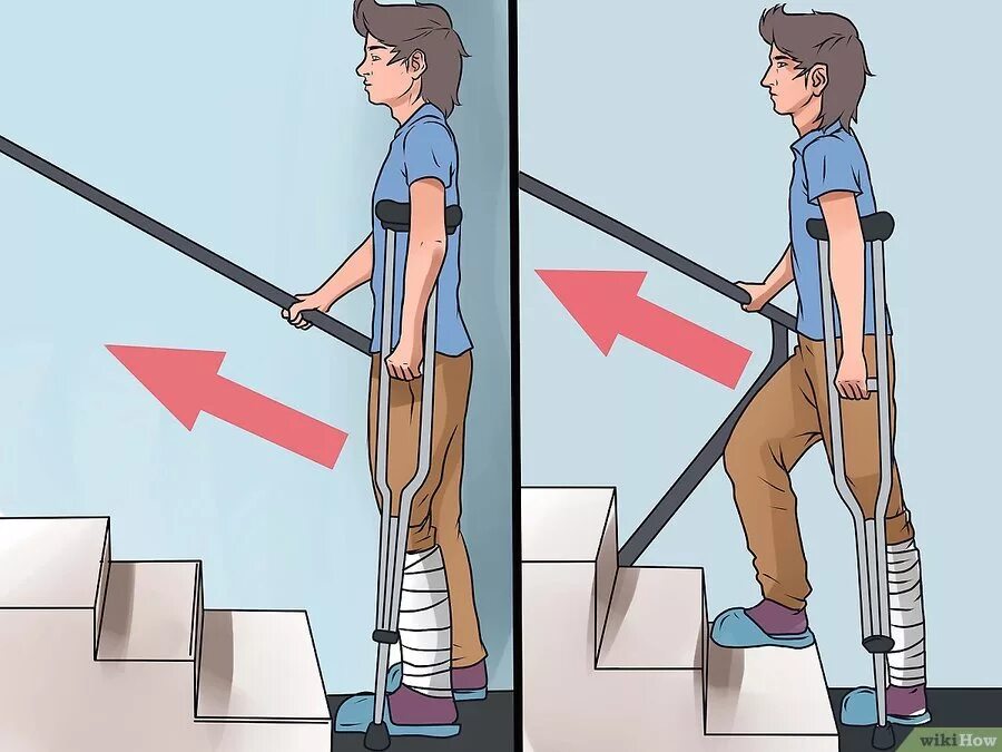 Как подниматься по лестнице после эндопротезирования. Техника хождения на костылях по ступенькам. Ходьба на костылях по ступенькам. Как правильно ходить на костылях. Спуск по лестнице на костылях.