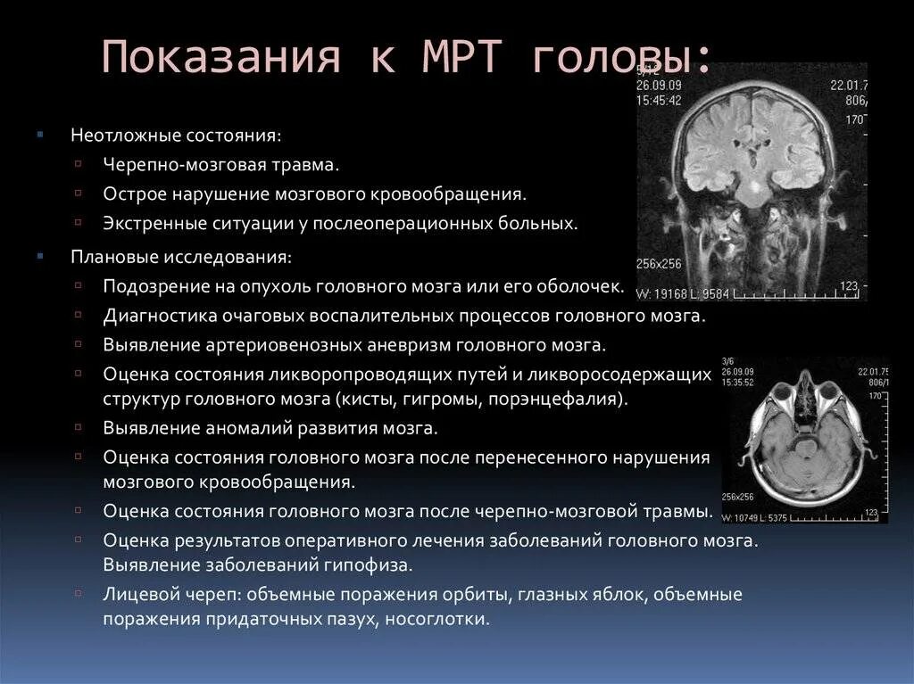Через сколько делают повторно кт. Мрт головного мозга показания. Компьютерная томография головного мозга показания. Показания к проведению мрт головного мозга. Показания к мрт головы.