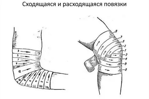Черепашья повязка