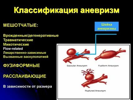 Операция мешотчатой аневризмы