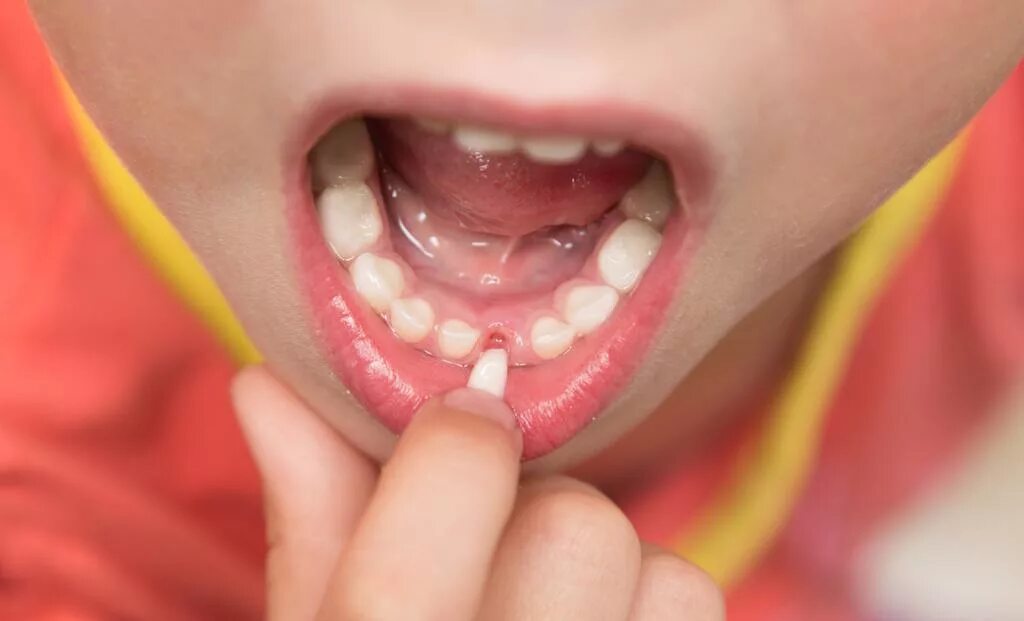 Ребенок год скрежет зубами. Растут коренные зубы у ребенка.
