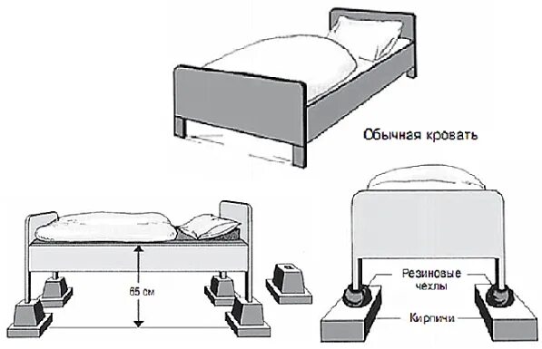 Кровать после операции на тазобедренном. Высота кровати после эндопротезирования тазобедренного сустава. Высота кровати после эндопротезирования. Приподнять кровать. Высота кровати после эндопротезирования тазобедренного.