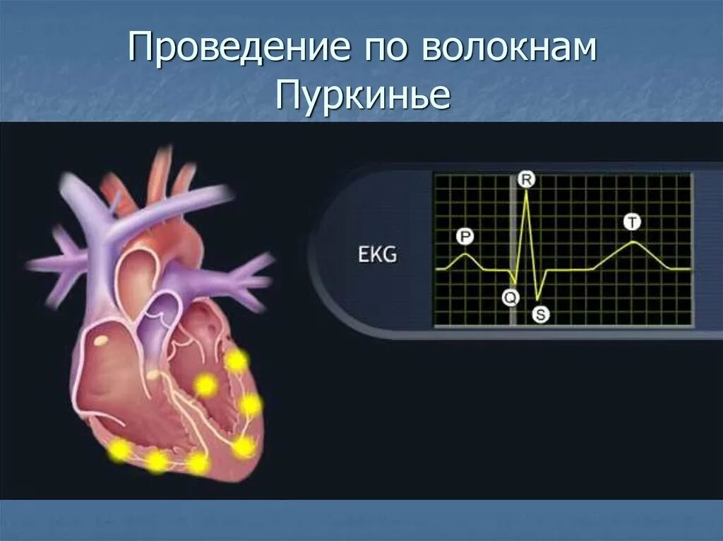 Пучок пуркинье. Волокна Пуркинье строение. Клетки Пуркинье в сердце. Система волокон Пуркинье.