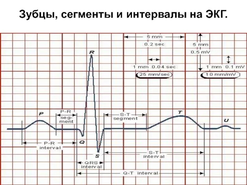 Интервал и сегмент экг. Экг зубцы интервалы комплексы сегменты. нормальная экг зубцы сегменты интервалы. зубцы интервалы и сегменты экг норма. электрокардиограмма зубцы сегменты интервалы нормы.