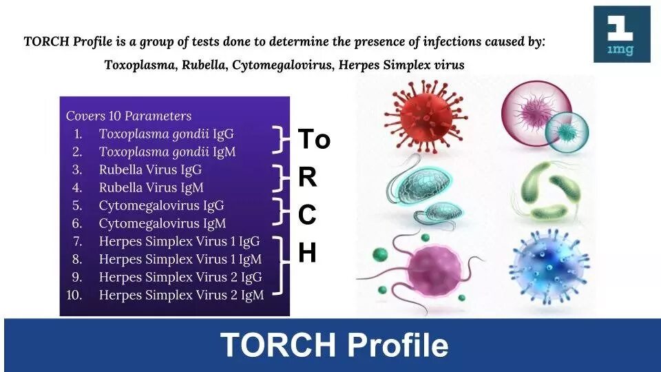 Torch examples