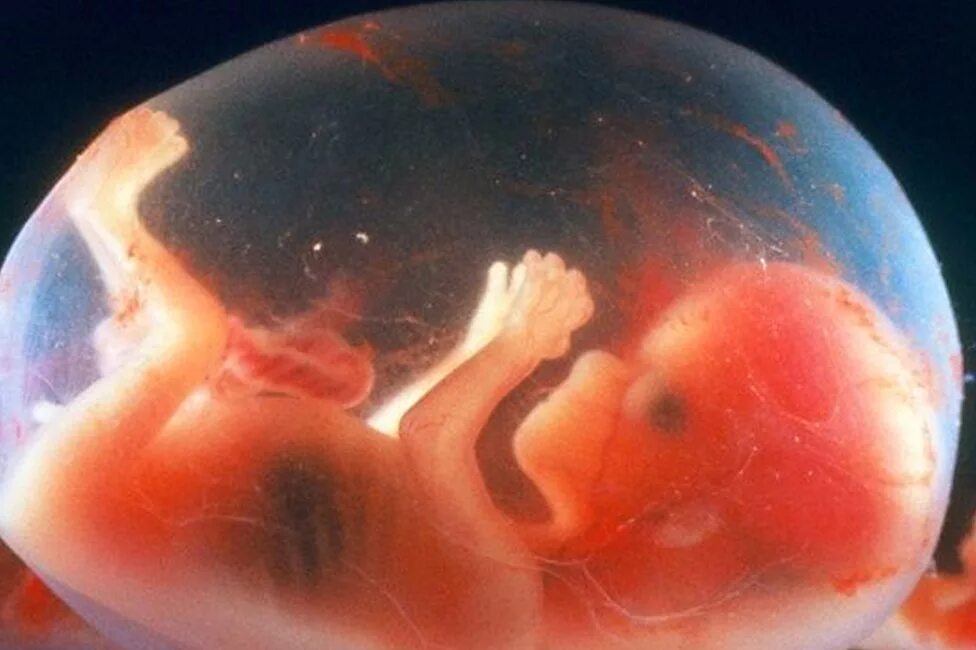 Плод становится человеком. Эмбрион на 14 неделе беременности. 14 Недель беременности фото плода. Плод ребенка на 14 неделе беременности фото. Эмбрион на 13 неделе беременности.